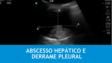 HEPATICO